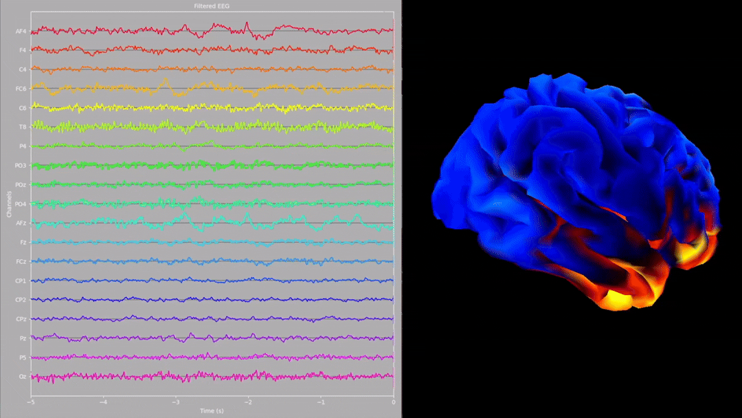 ThinkFlow